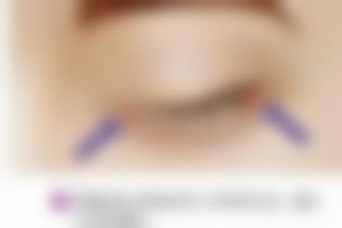 北京张海明整形美容门诊部医院技术好不好？