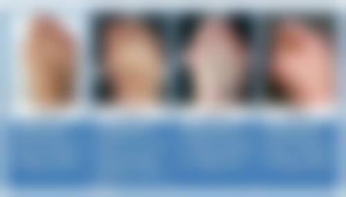 许昌正美韶华医疗整形医生与开展项目