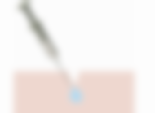 宁波鄞州玉晟医疗美容诊所医院技术好不好？