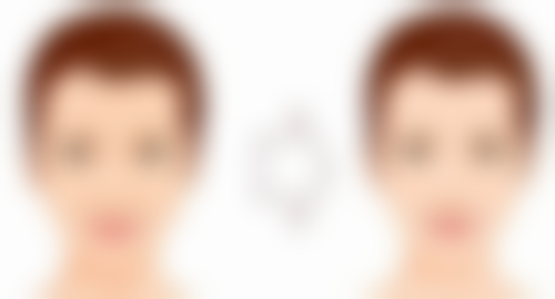 武汉斯启诺医美科普：眼袋整形适合哪些人呢？