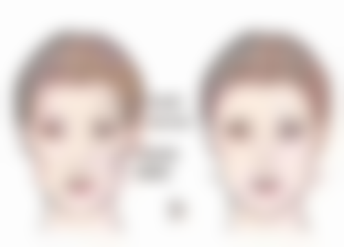 石家庄悦美医疗美容门诊部医院技术好不好？