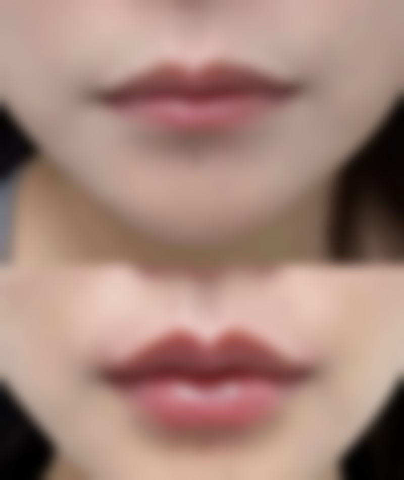 总结——北京摩尔星美整形医院怎么样?