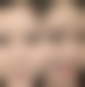 庆阳华美整形医院收费标准参考