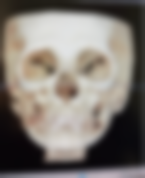 广州暨莱暨美医疗美容诊所收费标准参考