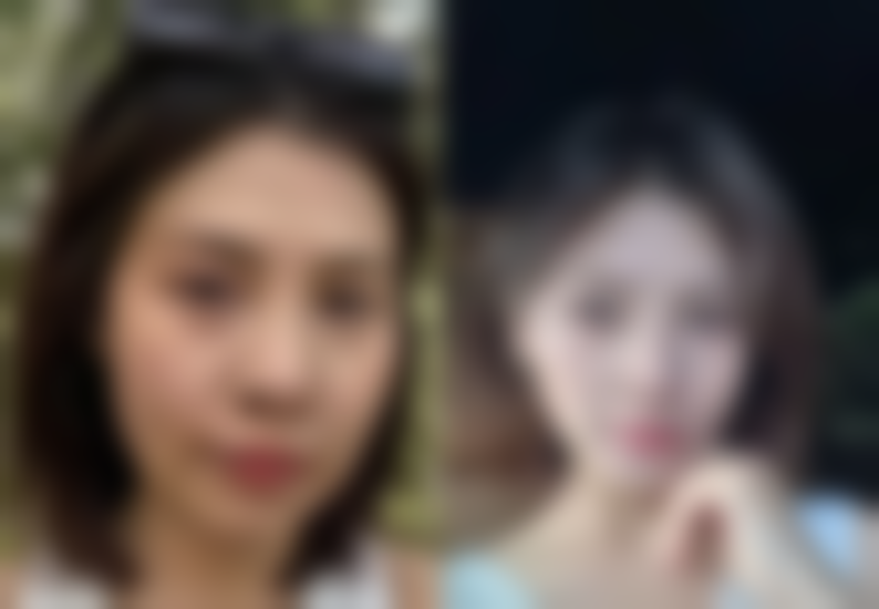 广州暨莱暨美医疗美容诊所硬件设备精良！