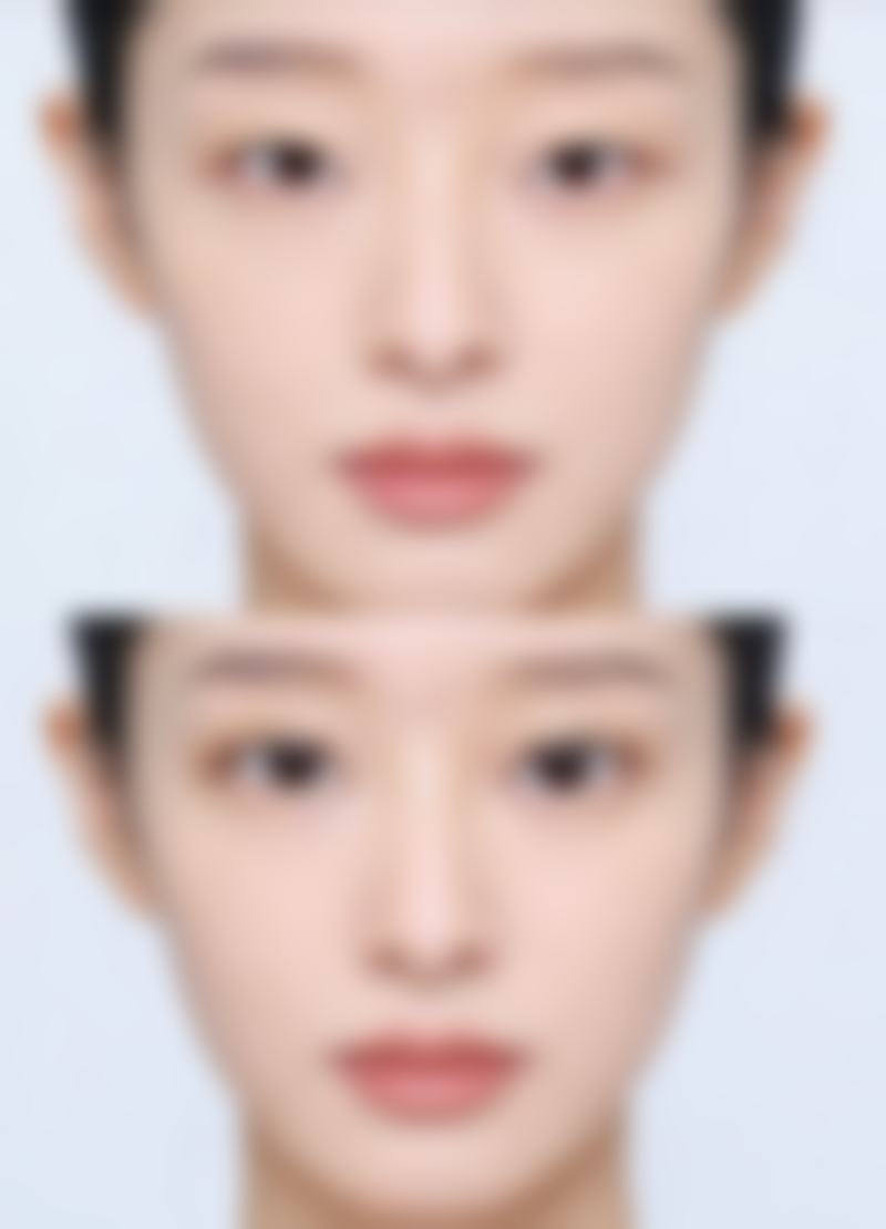 北京摩尔星美整形医院口碑如何?