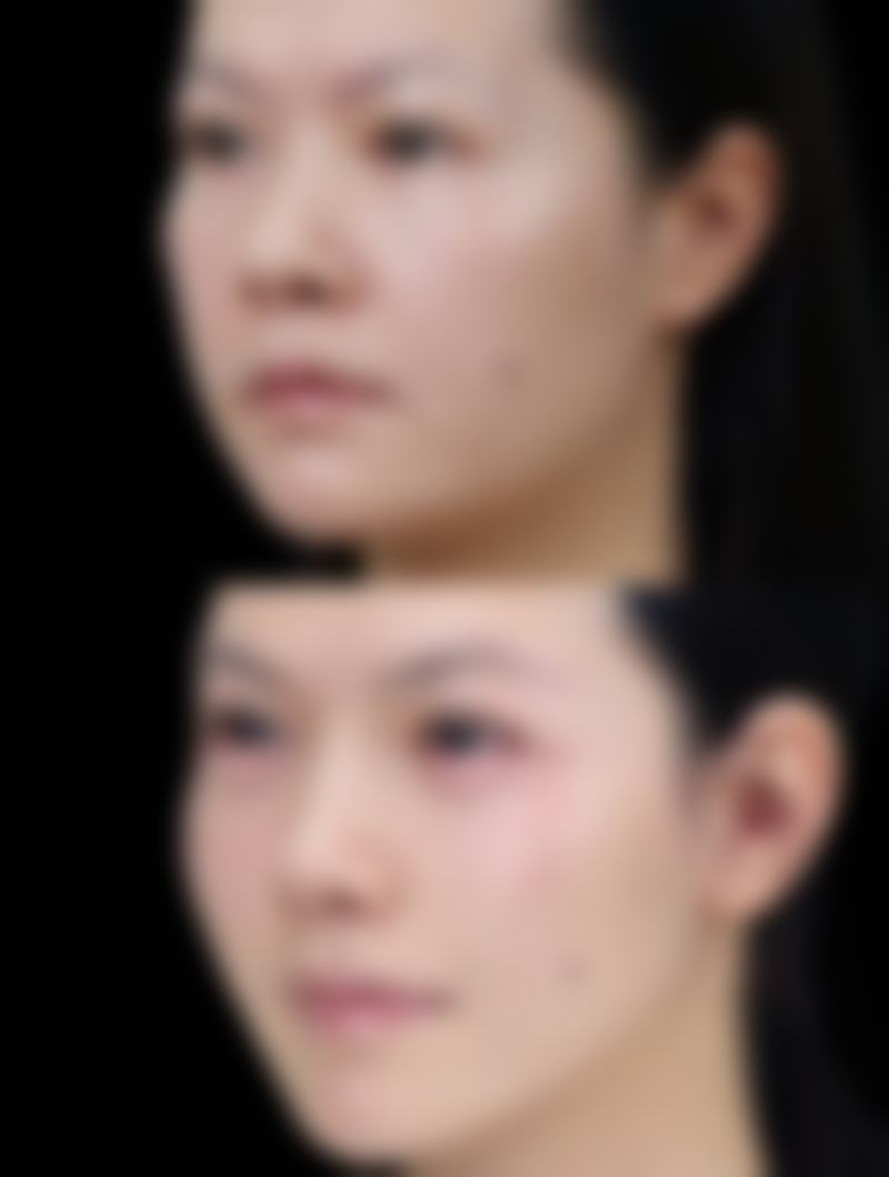 许昌正美韶华医疗整形口碑评价