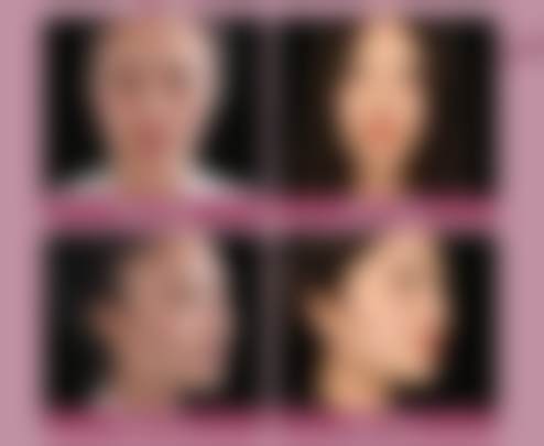 北京美莱医疗美容医院杨育茹医生技术好不好？