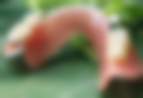 大连悦美格整形收费标准参考