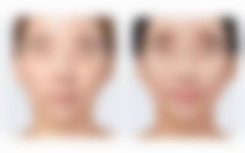 大连悦美格整形硬件设备精良！