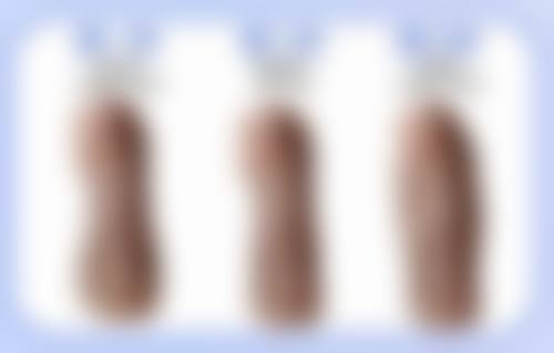 江西 南昌十二医院植发科医院技术好不好？