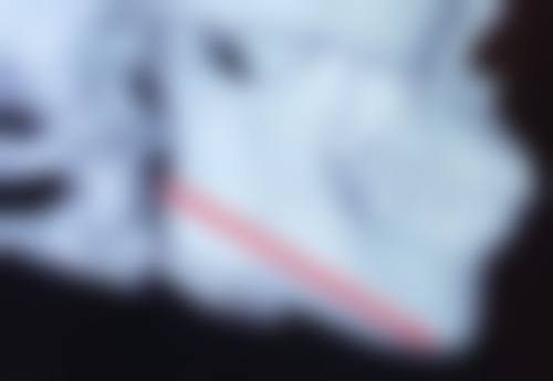 大连悦美格整形医院技术好不好？