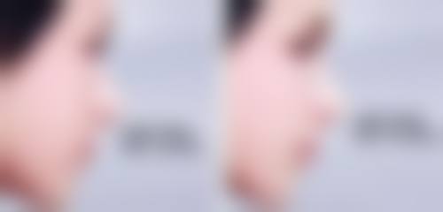 海口艾菲丝美容医院口碑如何？