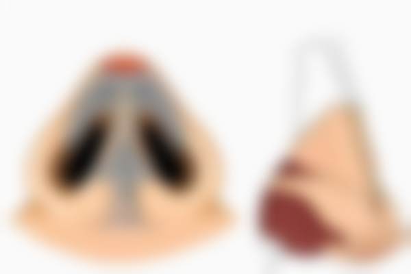 北京蕾士悦容热拉提PLUS全方面部 + 下颌缘（不含眼周）定点模式适合哪些人？