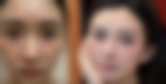 北京美雅枫医疗美容医院硬件设备精良！