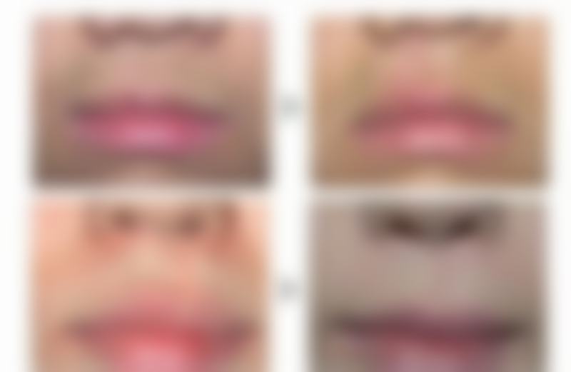 总结——成都青羊成一整形门诊部怎么样？