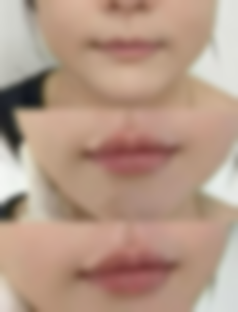 海口聚美辰赫辰医疗美容医院电话号码及预约方法