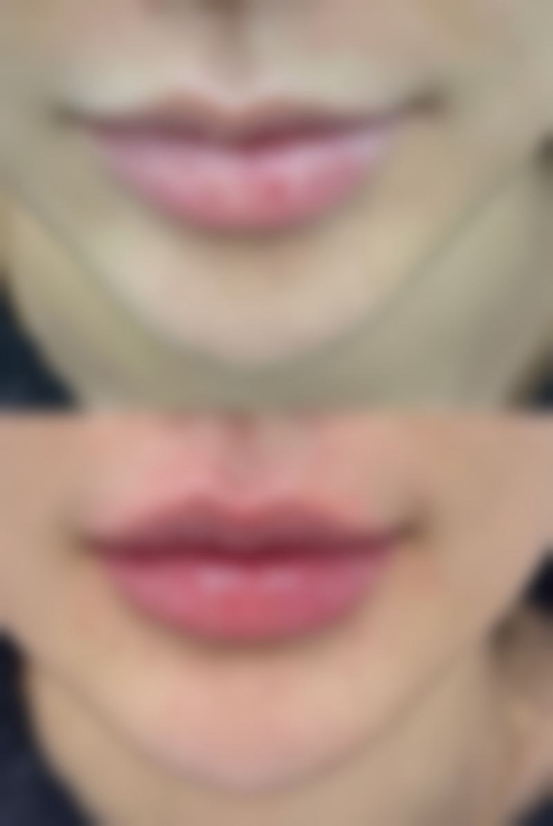 江阴漾禾整形医院营业时间