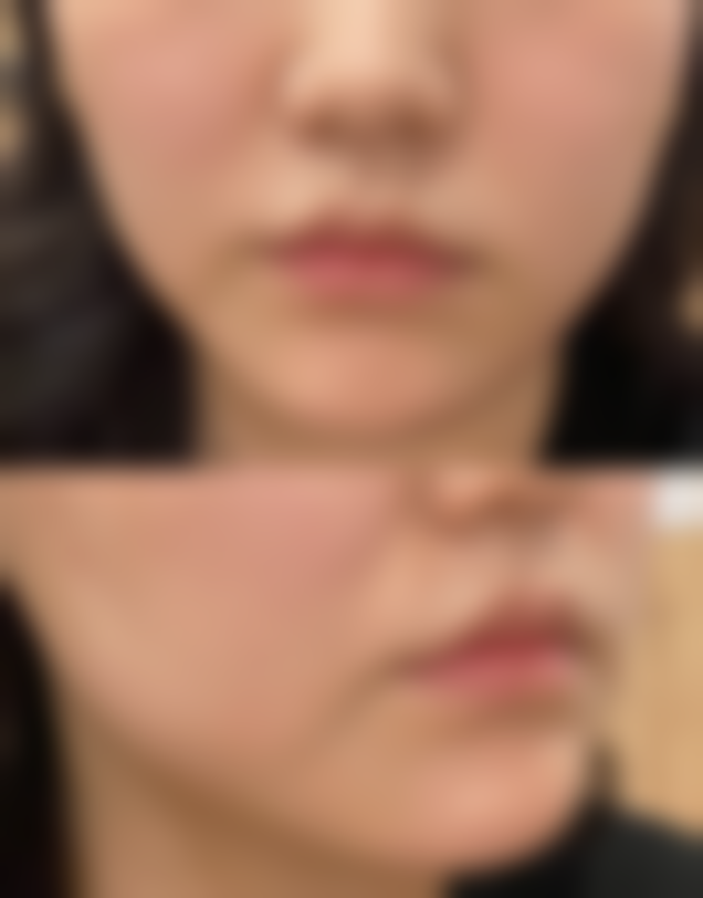 皖南医学校第二附属医院整形美容科硬件设备精良！