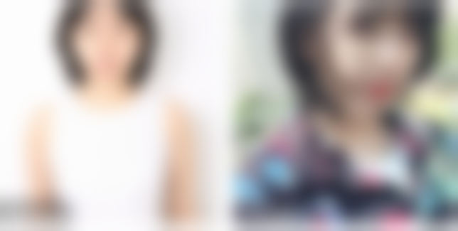 贵阳美莱医美黄剑美医生注射美容技术怎么样？