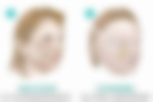 衡阳希美医疗美容门诊部收费标准参考