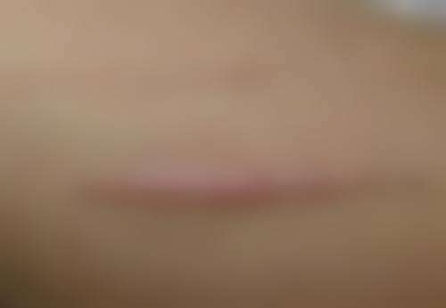 宁波海曙清媛（爱美丽）医疗美容诊所收费标准参考