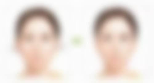 广州昊妍整形医院口碑如何？