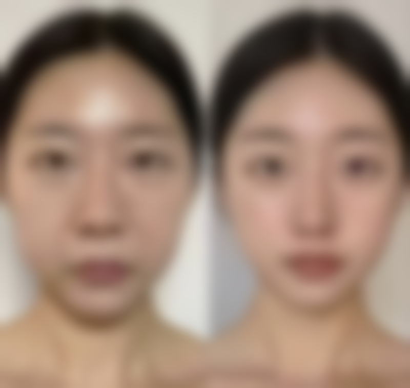 总结——宁波海曙清媛（爱美丽）医疗美容诊所怎么样？