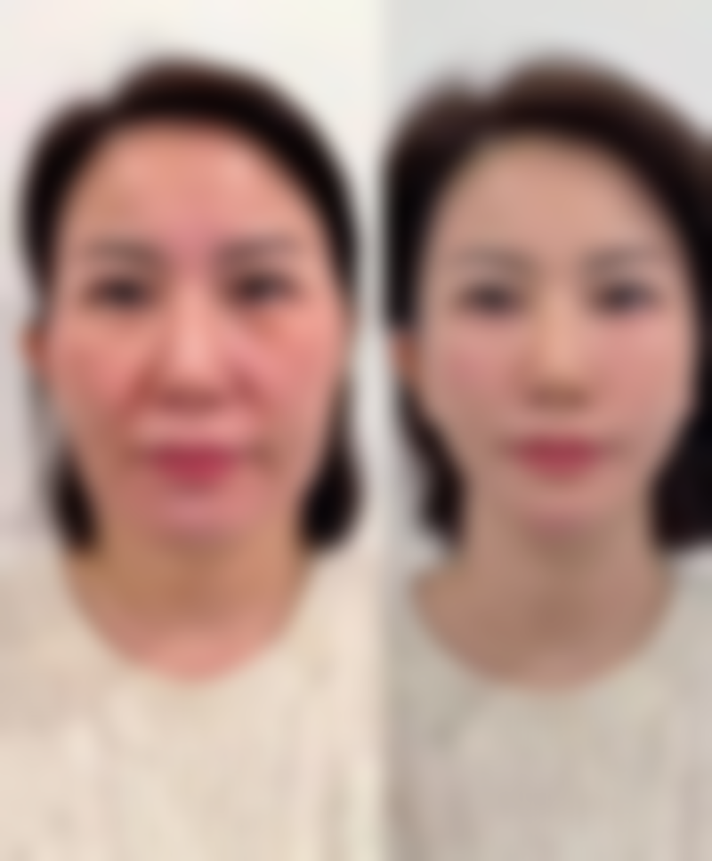 天津觅龄空间整形医院收费标准参考