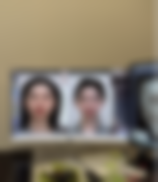 达州爱尔博视医院周奇志医生技术好不好?