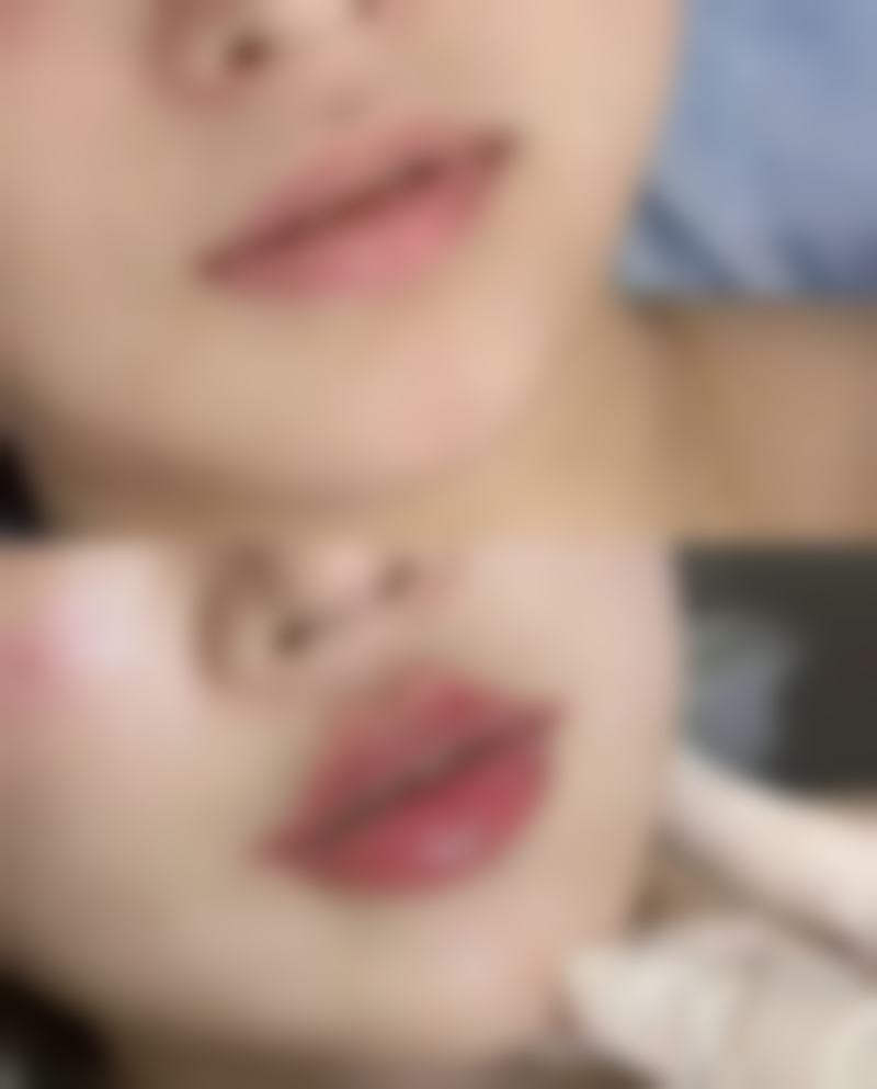 总结——达州爱尔博视医院周奇志医生怎么样?