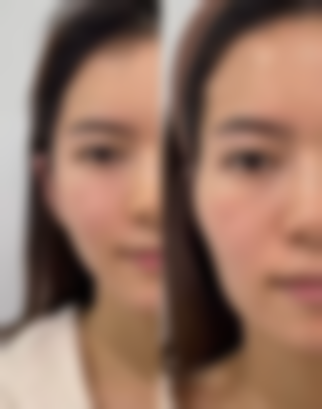 武汉凯丽恩医疗美容医院技术好不好？