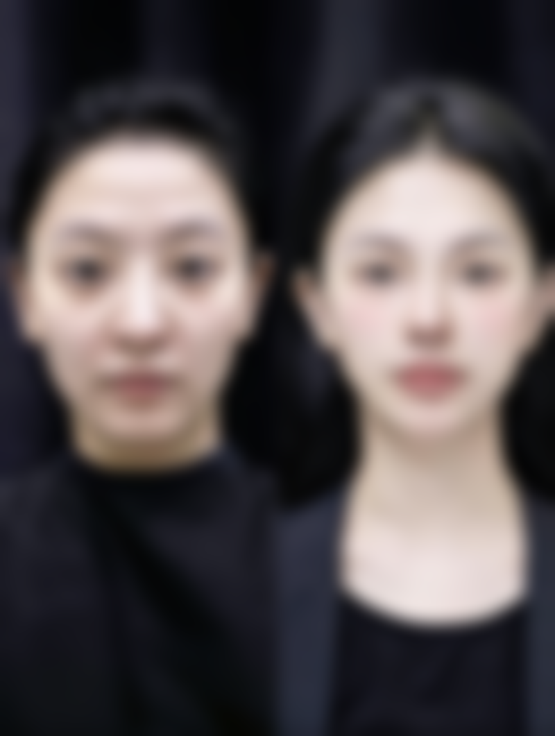 广州雅贝壹整形医院电话号码及预约方法