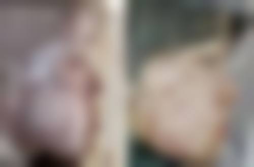 徐州薇莱美医疗美容诊所电话号码及预约方法