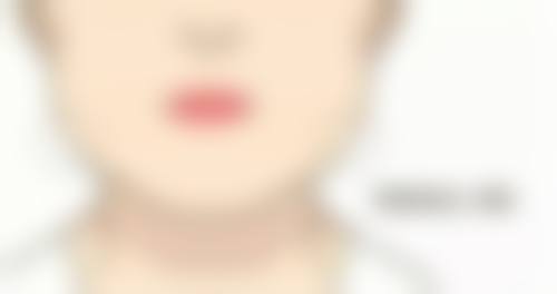 牡丹江蒂依夫人整形医院医院技术好不好？