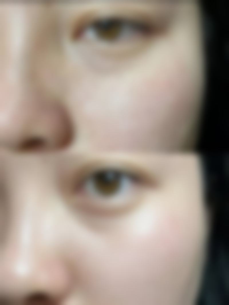 总结——武汉至美美容整形门诊部怎么样？