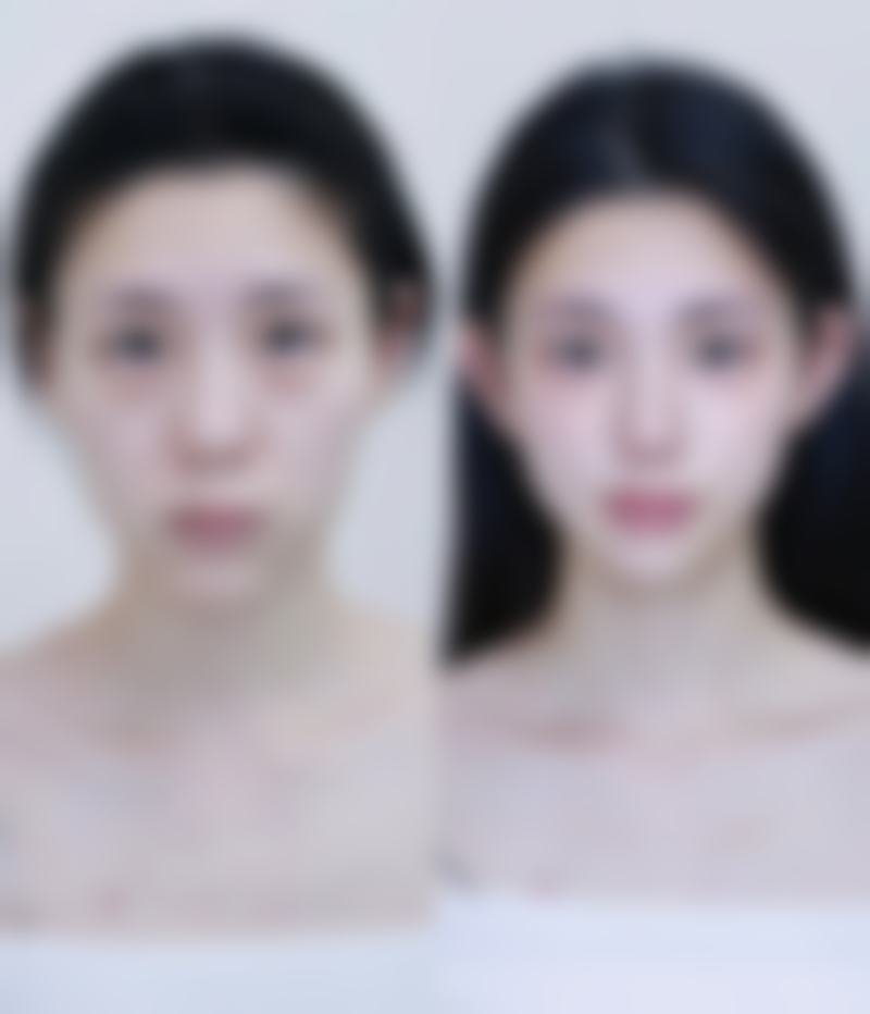 台州牙科医院收费标准参考