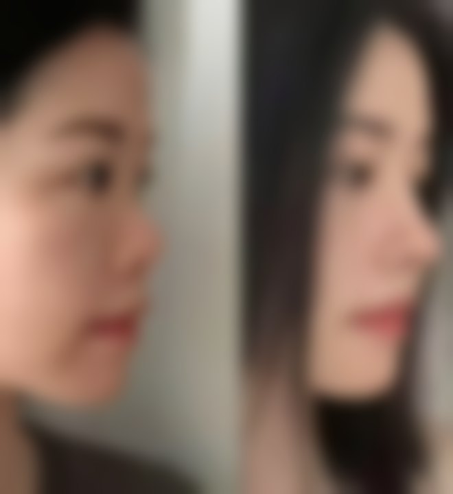 总结——徐州薇莱美医疗美容诊所怎么样?