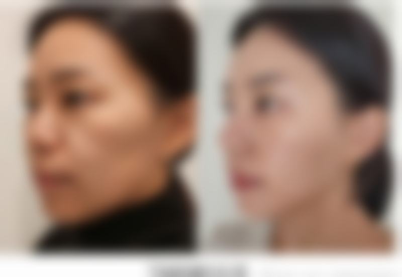 北京禾欣医疗美容门诊部收费标准参考