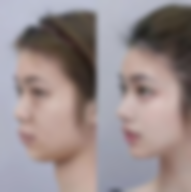 南通科禾毛发移植医疗美容诊所收费标准参考