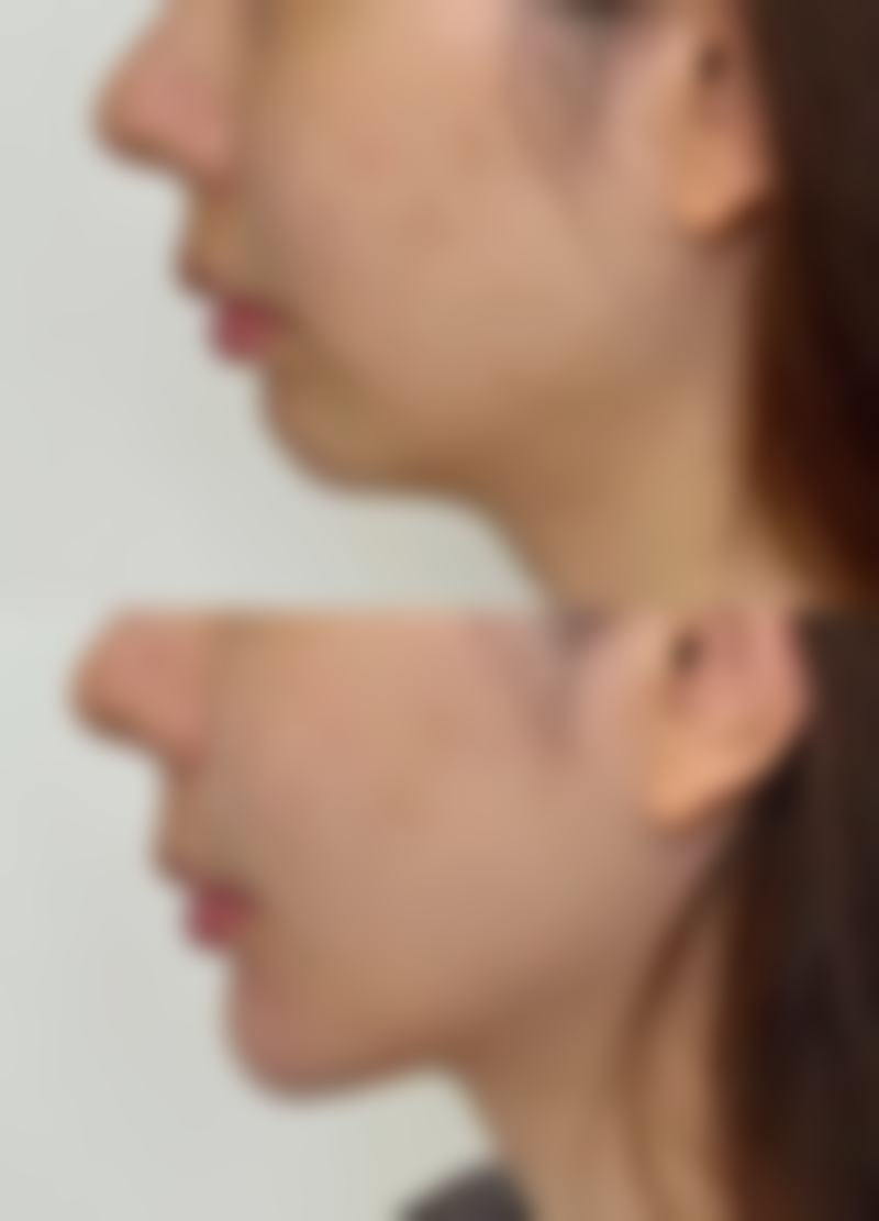 总结——宿州韩仕医疗美容诊所丁淑茹医生怎么样？