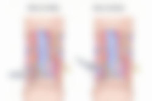 其他治疗方法去除脸上手术疤痕