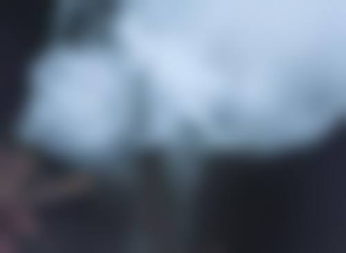 双眼皮做得太窄了怎么办？先看恢复情况再选修复法，还得挑好医院医生