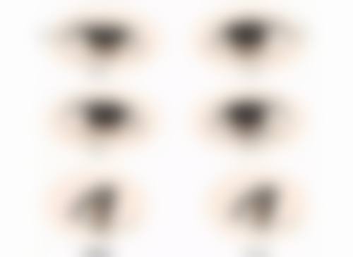 博朗温整形外科医院崔慧林医生技术好不好？