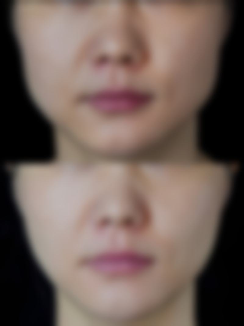 济宁二院整形美容科口碑如何？