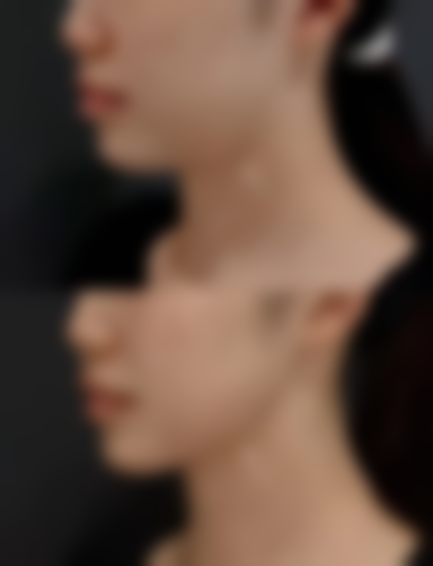 总结——广州中山大学附属第三医院茹扎医生怎么样？