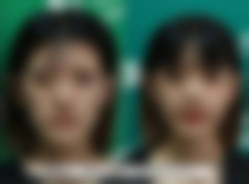 石家庄美然医疗美容赵志娇医生技术好不好？