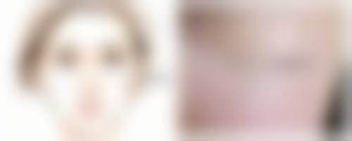 不同手术方式对假体隆胸住院时间的影响