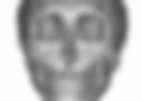 一般隆鼻要多长时间？不同方式手术、恢复及维持时间差异大受多因素影响