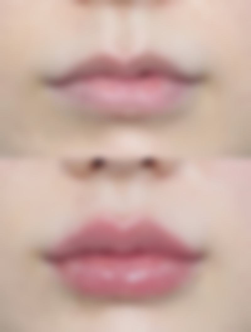 总结——石家庄美然医疗美容孙卫海医生怎么样？